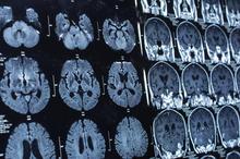 Google 的 DeepMind 和 NHS：一瞥人工智能對未來醫療保健的意義