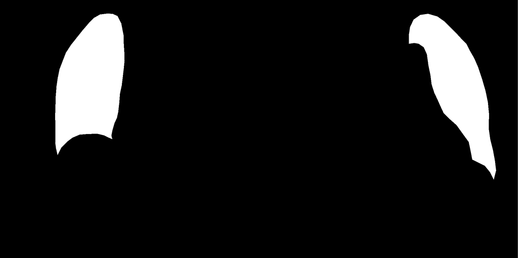 去除影像區域之間的間隙