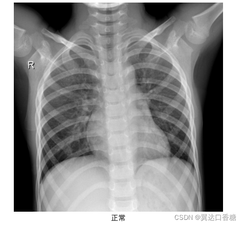 請添加圖片描述
