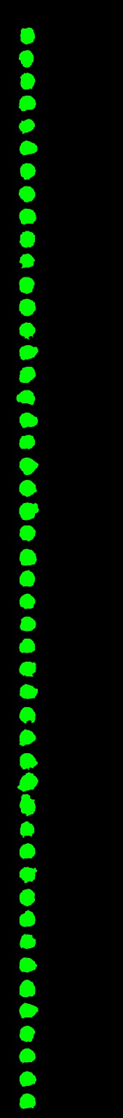 OpenCV OMR 表 - 在 Python 中檢測標記的答案 - 獲得正確的二值化
